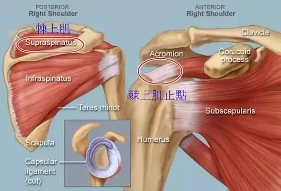 肩痛不一定是五十肩认识冈上肌激痛点
