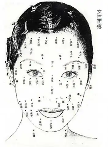 痣分善恶?女痣相小观