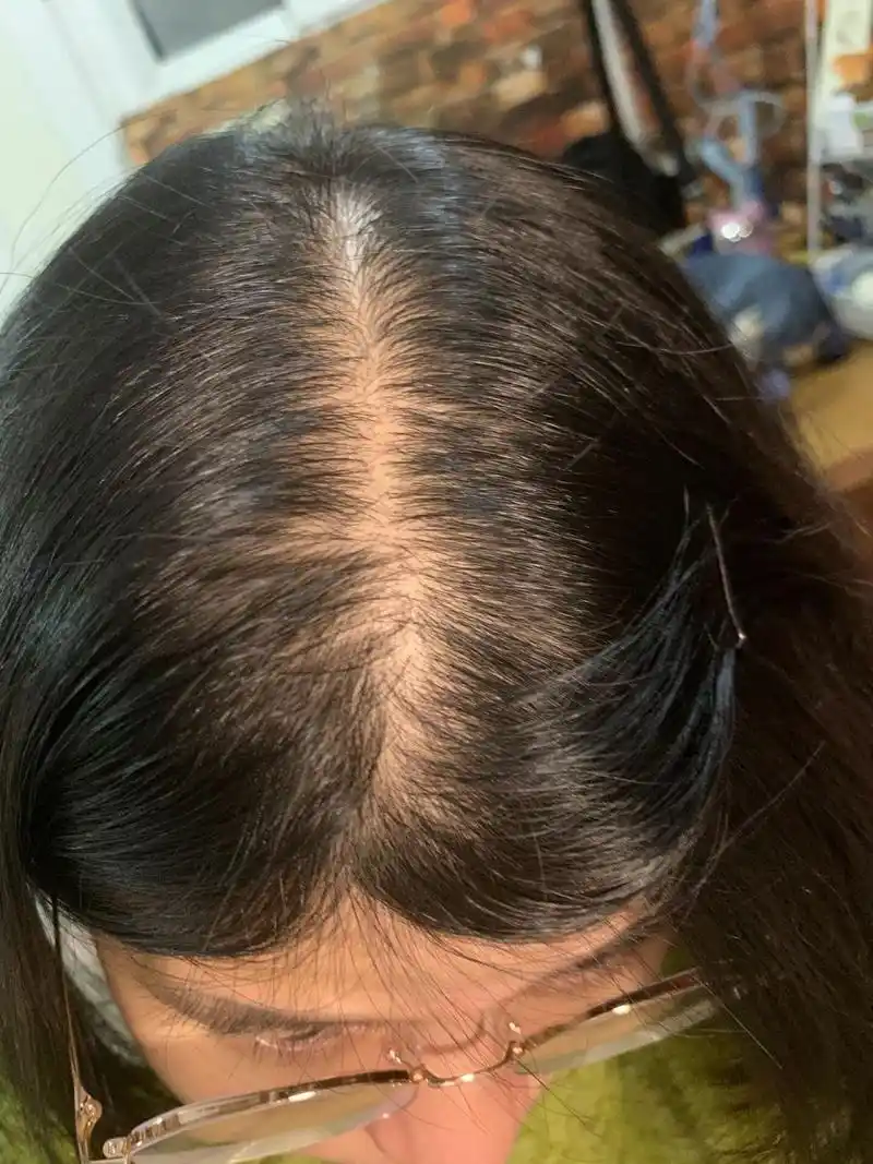 找到秃头女生适合的发型啦! 真的好嫩!