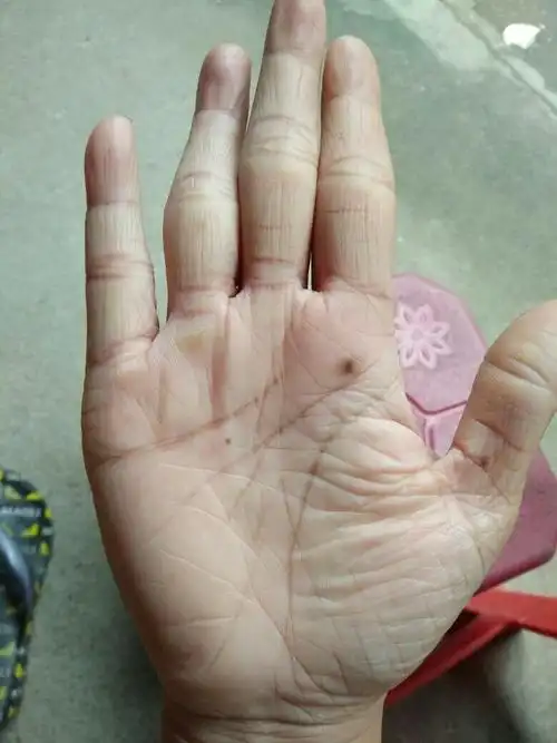 手上有痣图解女士,手上的痣图解女士右手-图片大观-奇异网