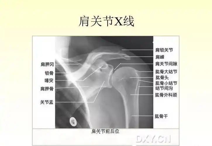 肩关节疾病的的临床诊治技巧 - qinchuo7998的主页