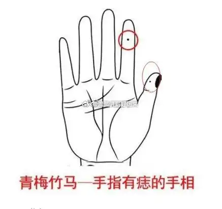 大多都来自身边大拇指上长痣图解手指有痣图解女人食指的左手有一个痣