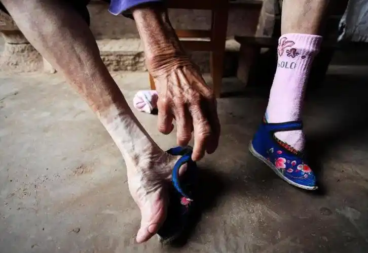 那些年的裹脚老人这才是原始的小脚太太最后一张让人不忍直视