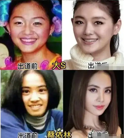 漂亮女明星出道前后的变化对比你最喜欢谁呢