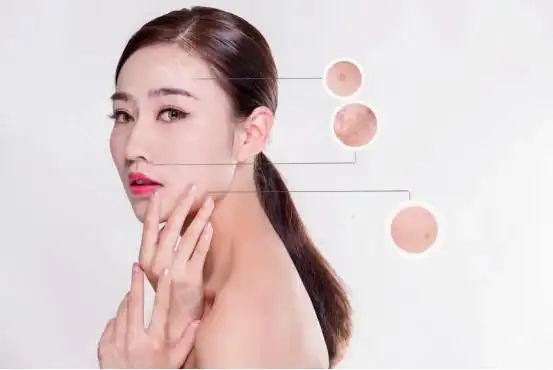 哪些医美项目能够有效收缩毛孔?