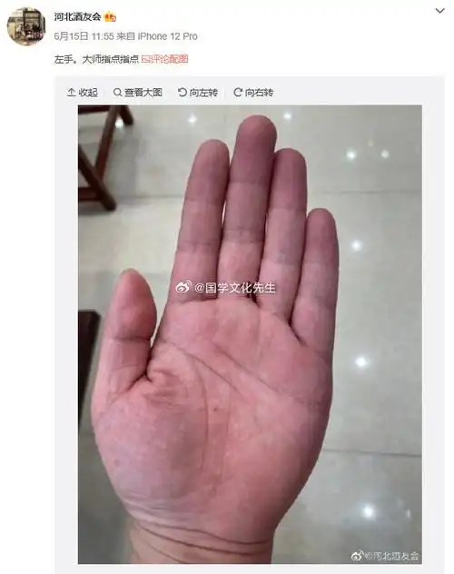 这也是发展事业的所具备的条件之一女人左手掌有痣手掌金星丘有痣男人