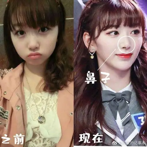 青春有你2选手出道前后对比孔雪儿微调许佳琪变化超大
