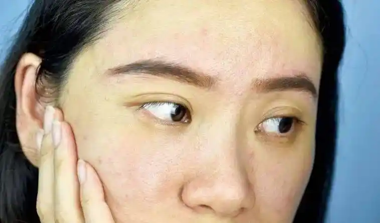 皮肤暗沉,发黄,该怎么挽救?_精华_补水_图片