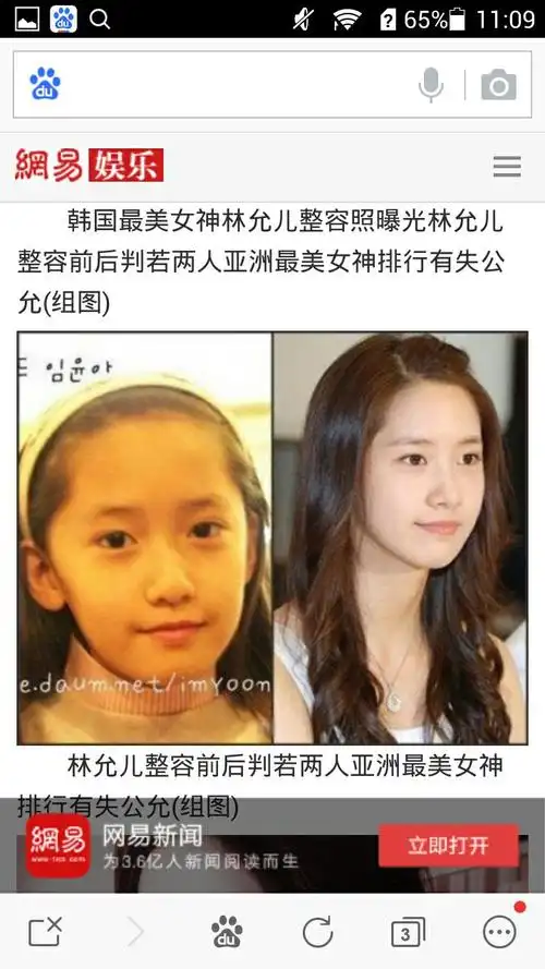 展开全部 林允儿17岁出道,韩国18岁之前整容犯法,出道之后她也没有