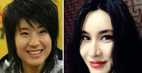 尚雯婕整容前尚雯婕为什么脸型和以前不一样
