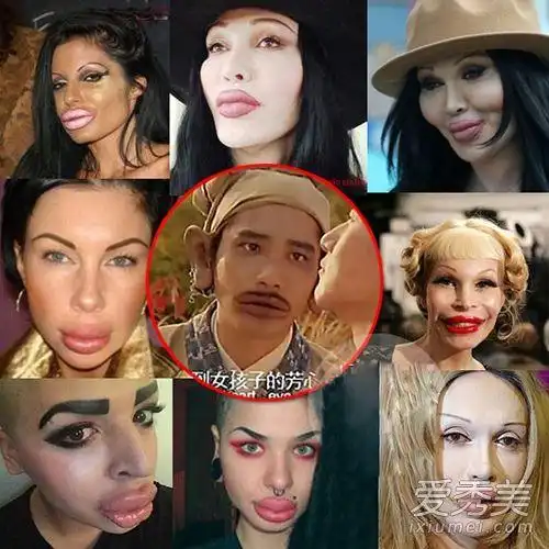 巩新亮郑爽孙菲菲萧蔷baby揭明星整容最怕后遗症(组图)