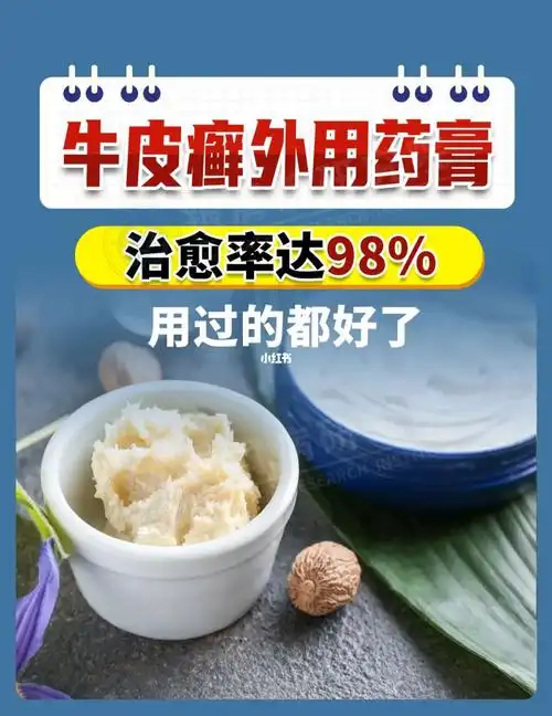 绝绝子银屑病外用药膏‼️用过的都好了‼️