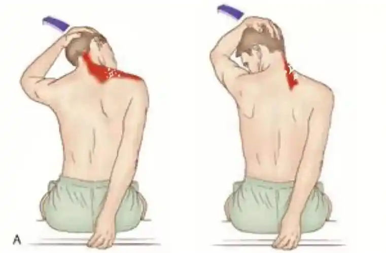 分享几个有效的方法缓解颈部酸痛73左边拉伸的目标肌肉是上斜方肌