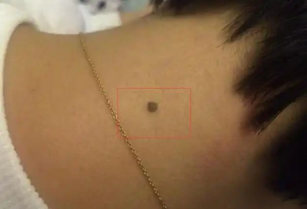 有"苦情痣"会有这样的命运?_星座_尚斯网