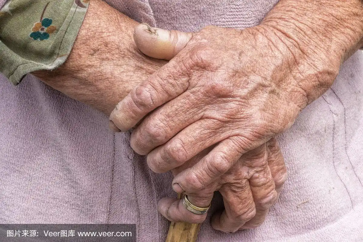 衰老过程——老年妇女双手皮肤起皱