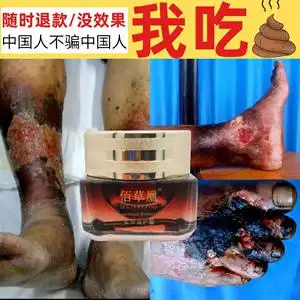 老烂腿专用药静脉曲张老烂腿脉管炎老烂腿生机膏老烂腿伤口愈合