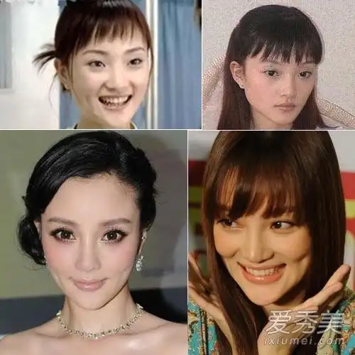 12位女星晒未整容证据angelababy捏下巴