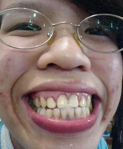 网络丑女排行榜top20-美女-养眼搞笑-杭州19楼