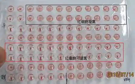 实验室是如何分离生物病毒的?