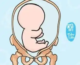 胎儿臀位的危害有哪些臀位是孕期异常胎位的一种,出现这类情况胎儿