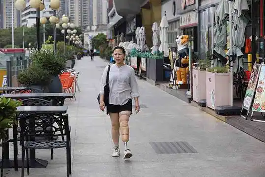穿戴假肢有哪些小技巧?_包布_大腿_阀门