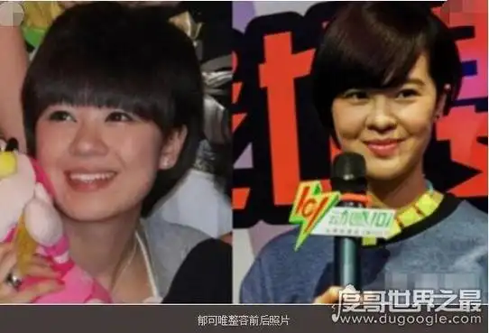 郁可唯整容前后对比照片曝光