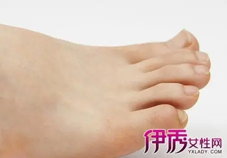 【图】讲解脚有酸味是什么原因 相关治疗方法助你解决烦恼