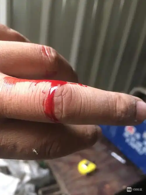 站着看看,一动手就受伤,今天我看不宜做事了