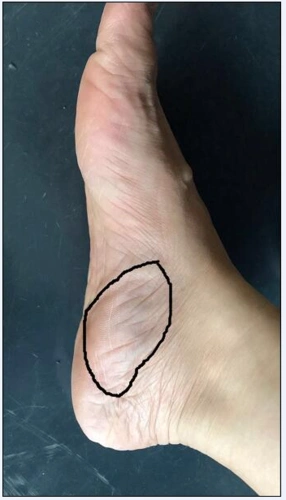 右脚掌这个部位每次早上起床走路就疼,想问去医院要挂什么科?