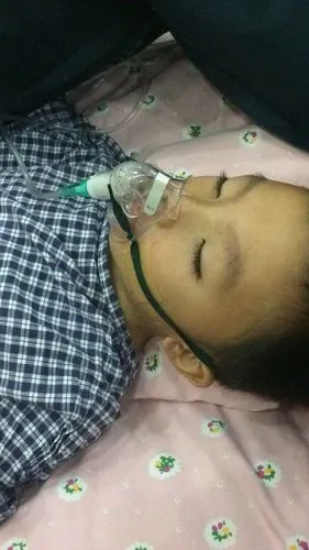 联影同事廖秀林5岁的孩子因重度肺炎病毒感染并发症病危,至今仍然挣扎