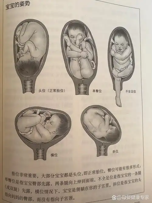 孕中期胎位 23周三维 胎位显示rsca 查了一下 原来是横位!