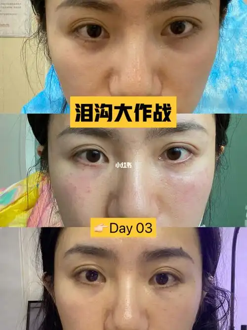 填泪沟的第三天