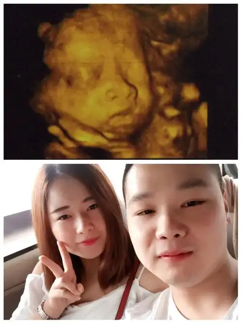 这是你的第一张照片(四维图)那时你还在妈妈的肚肚里安静的睡大觉,看