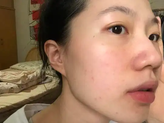 正常人的脸的毛孔图_小红书