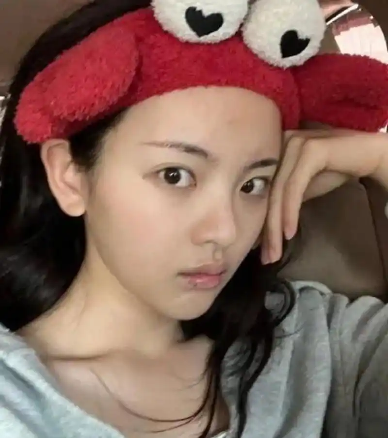 杨超越的素颜照,看着也很美,青春痘都可见呢