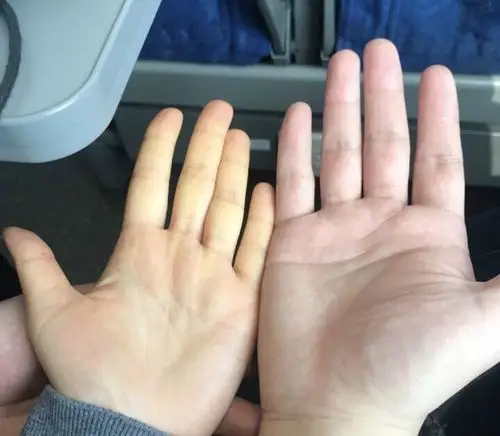 有姐妹手心比较黄的吗