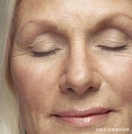 皱纹是怎样形成的?皱纹怎么消除?