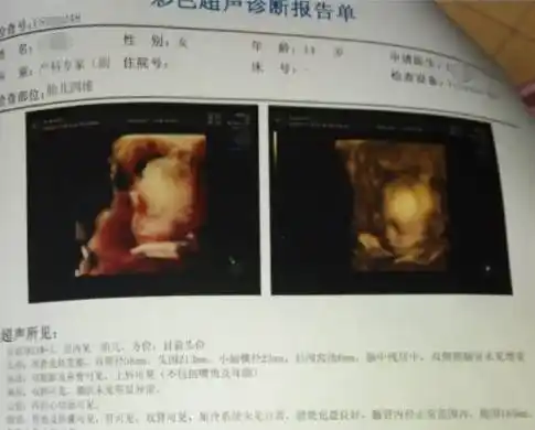 00后以晒怀孕为荣是谁消逝了他们的童年