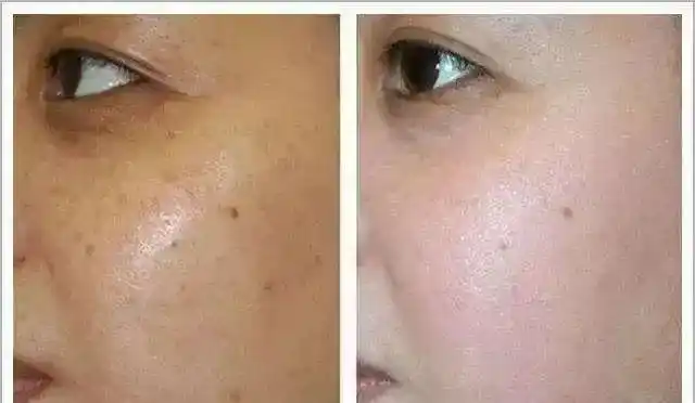 百人实测美白淡斑一抹柔化养出白嫩无暇明星肌