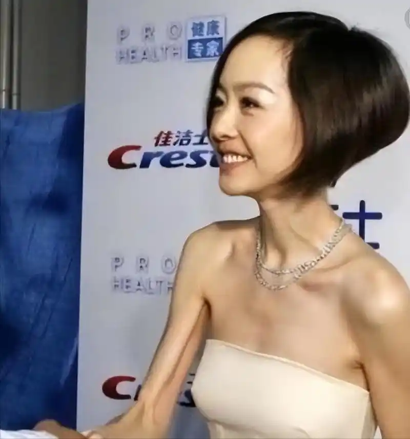 瘦脱相的10位女星:皮肉流失,行走的骷髅,瘦成纸片人真的不好看