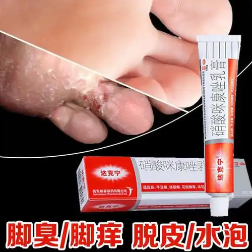 达克宁 硝酸咪康唑乳膏20g治脚气药脚痒脱皮水泡臭脚丫烂脚脚痒药