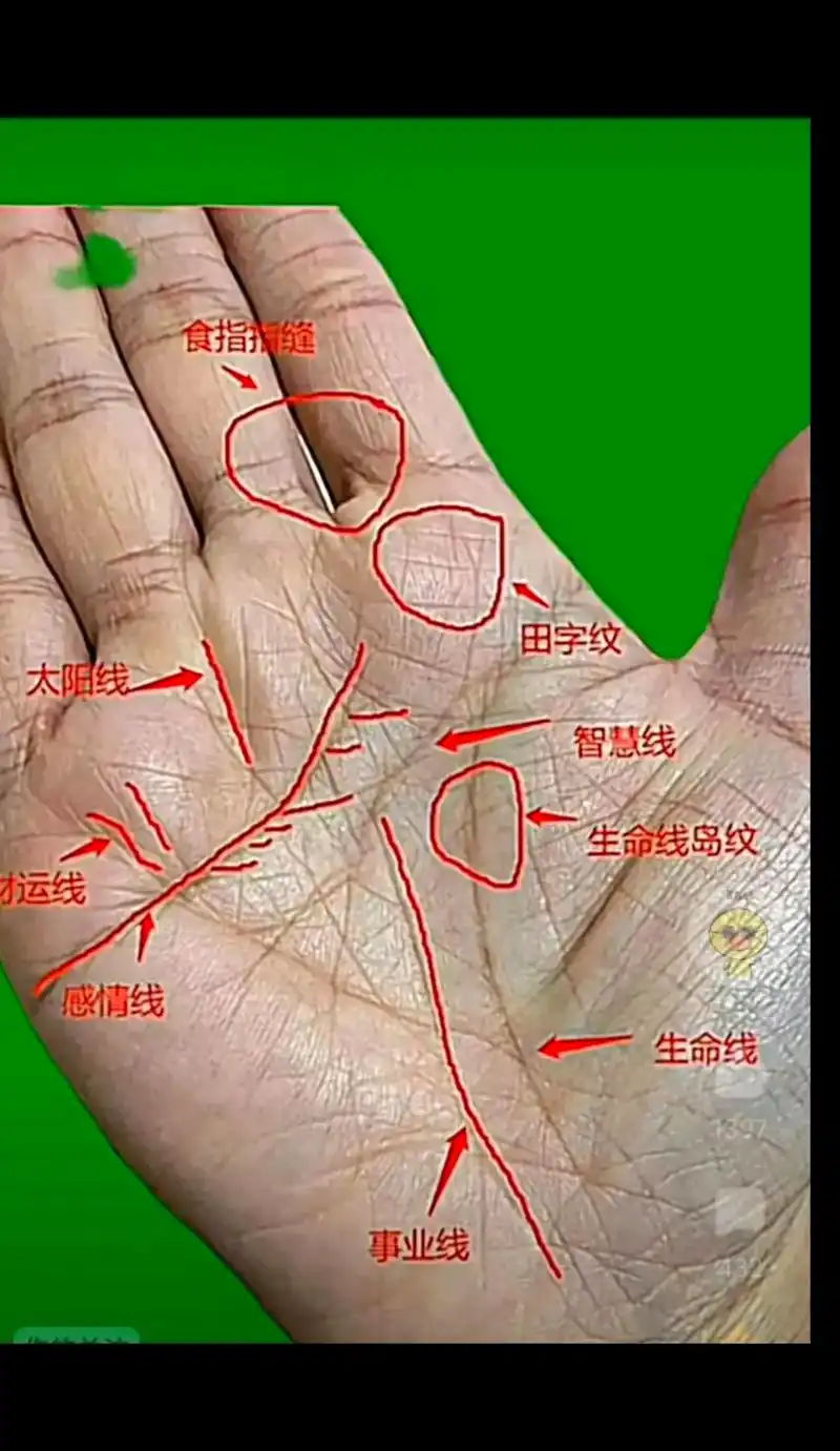 国学文化 #每天学习一点点 #痣的含义 #内容仅供参考 - 抖音