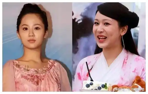 "整容后遗症"的回旋镖,还是扎到了金晨,杨幂的身上|杨紫|唐嫣|刘涛|女