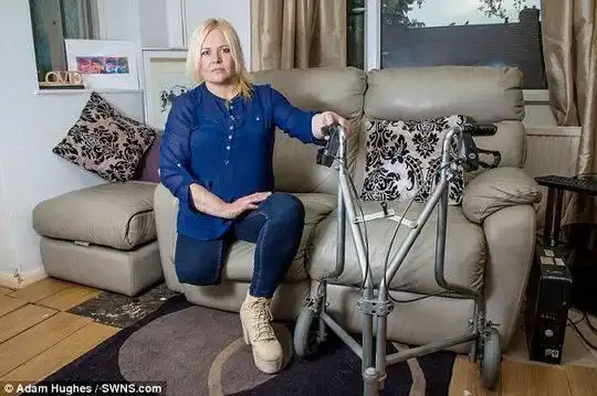 英国女子刮腿毛后右腿溃烂被迫截肢图