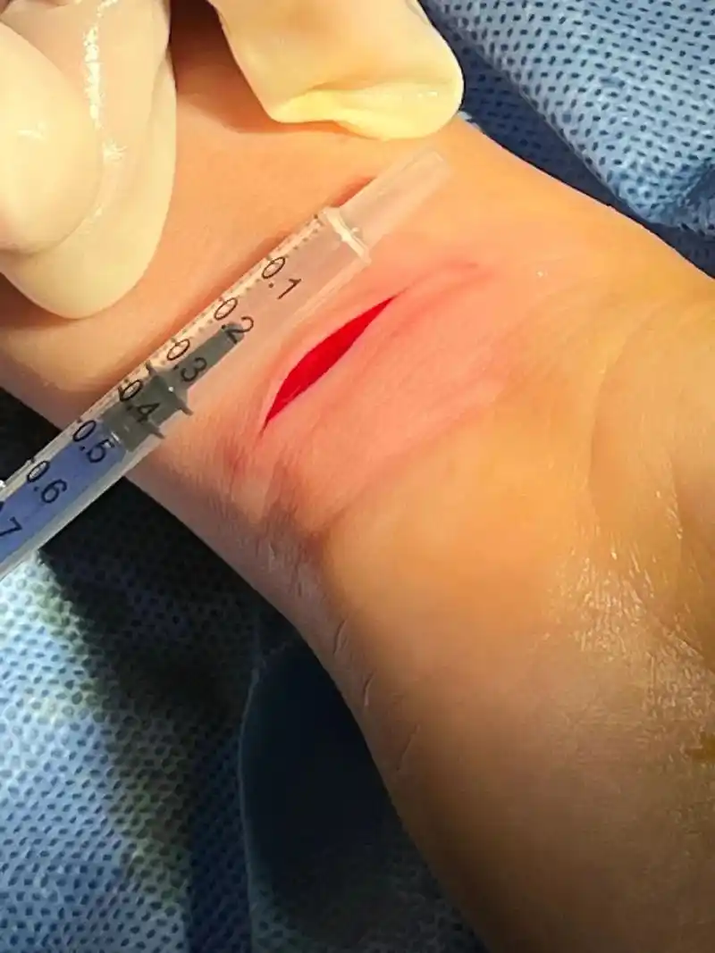 珍爱生命 #心理健康 #抑郁症 连续碰到手腕切割伤,呼吁关 - 抖音