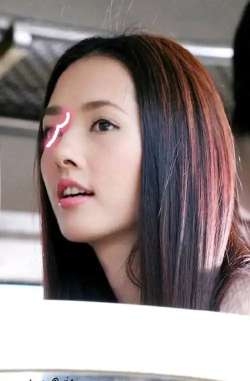 混血儿就会有驼峰鼻吗