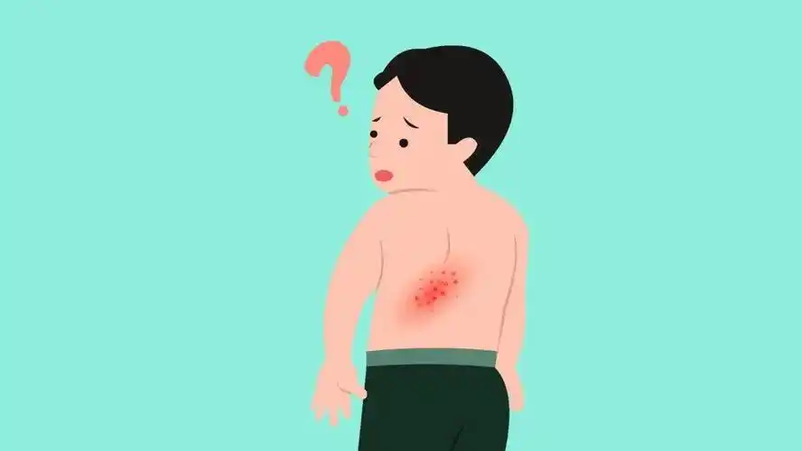 67@溆浦人|春暖花开好时节,警惕这些春季高发皮肤病!