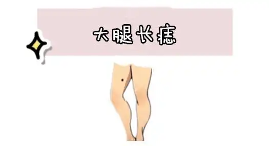 大腿长痣在相学当中,若是一个人的大腿的位置处长有吉痣,则往往这样的