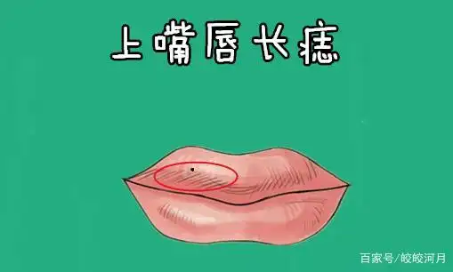 "万里挑一4颗痣",个个值大钱,一个生金,一个掌权,皇帝命!