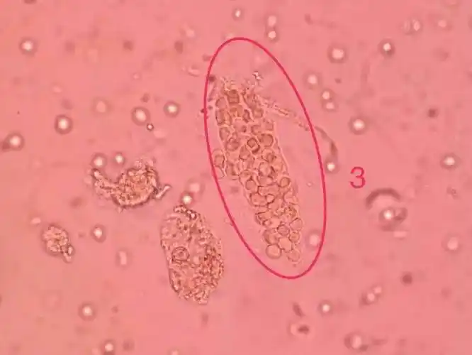 57.一个单底物酶促反应,单【s】  km时